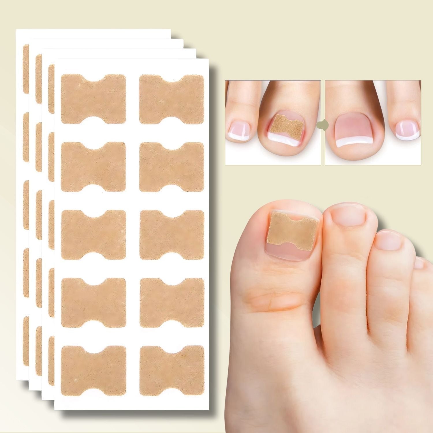 25+25 GRATIS | FixaNail - Onmiddellijke nagelreparatie