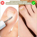 25+25 GRATIS | FixaNail - Onmiddellijke nagelreparatie