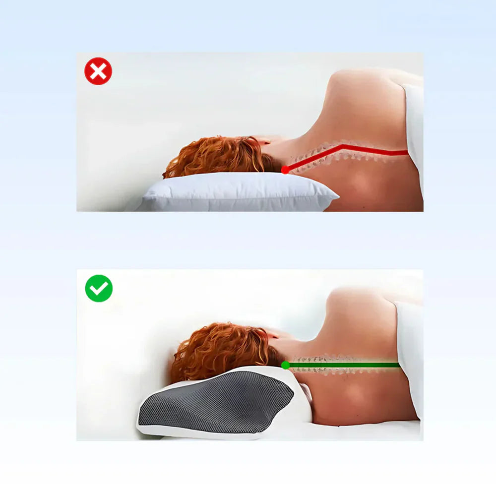 CervicalCare™ Ergonomisch Hoofdkussen