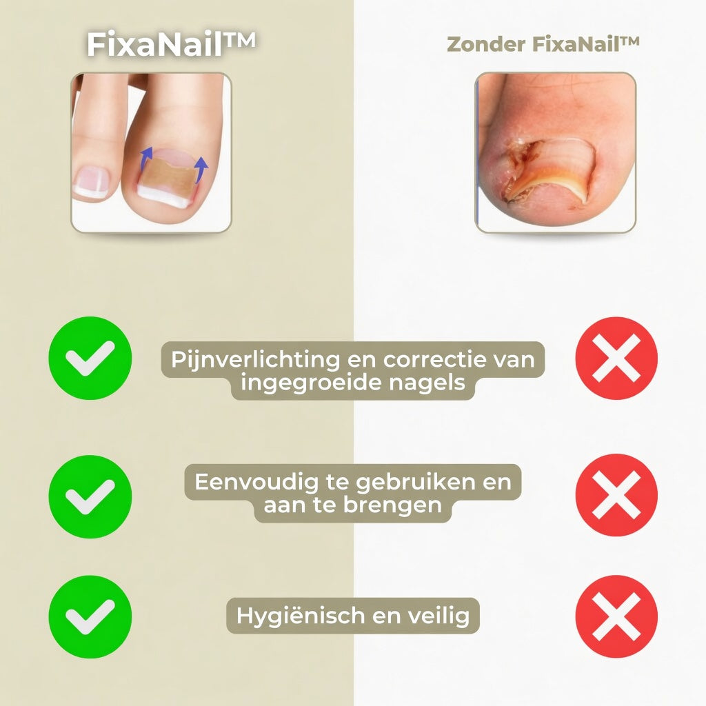 25+25 GRATIS | FixaNail - Onmiddellijke nagelreparatie