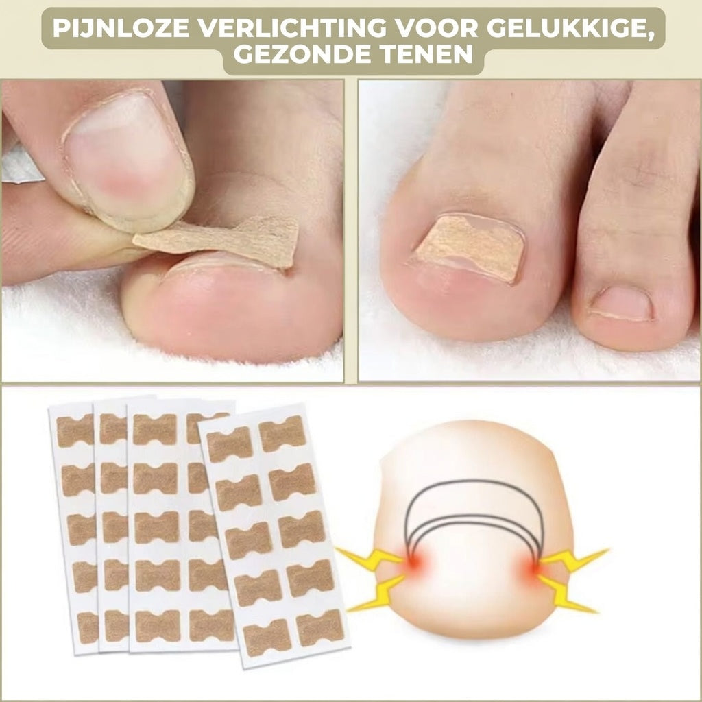 25+25 GRATIS | FixaNail - Onmiddellijke nagelreparatie