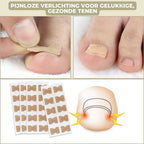 25+25 GRATIS | FixaNail - Onmiddellijke nagelreparatie